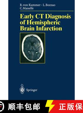 【3-4周达】Early CT Diagnosis of Hemispheric Brain Infarction [9783540600565]