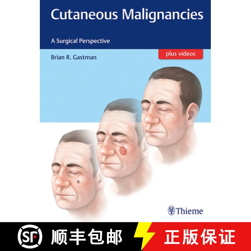 【3-4周达】Cutaneous Malignancies: A Surgical Perspective [9781626231474]