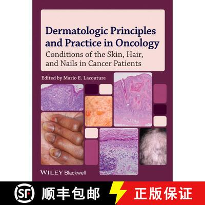 【3-4周达】Dermatologic Principles And Practice In Oncology; Conditions Of The Skin, Hair, And Nails ... [9780470621882]