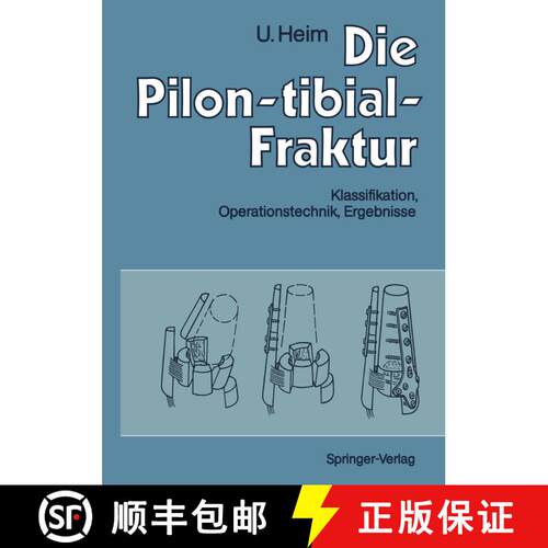 【3-4周达】Die Pilon-tibial-Fraktur: Klassifikation, Operationstechnik, Ergebnisse [9783642759604]