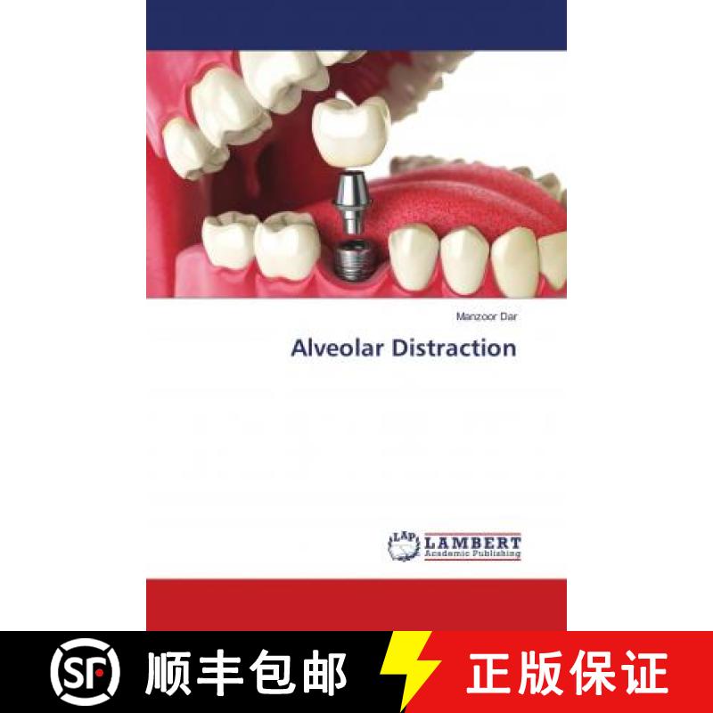 预订 Alveolar Distraction [9786139882748]
