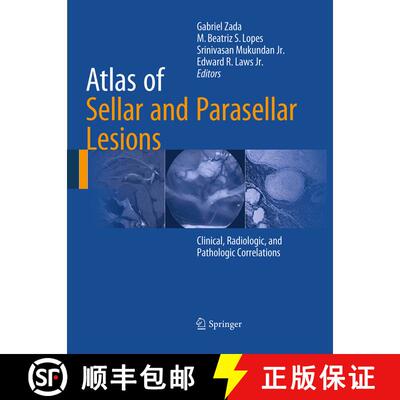 【3-4周达】Atlas of Sellar and Parasellar Lesions : Clinical, Radiologic, and Pathologic Correlations [9783319342719]
