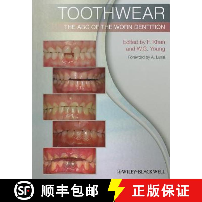 【3-4周达】Toothwear - The Abc Of The Worn Dentition [Wiley牙科医学] [9781444336559]
