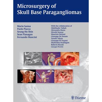 【4周达】Microsurgery of Skull Base Paragangliomas [9783131486110]