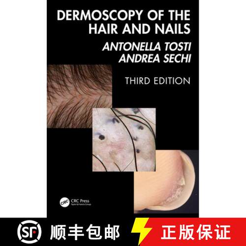 【3-4周达】精装 Dermoscopy of the Hair and Nails 3e [9781041020028]