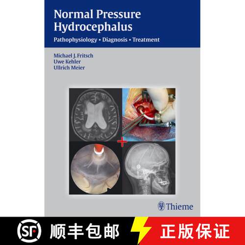 【3-4周达】精装 NPH - Normal Pressure Hydrocephalus: Pathophysiology - Diagnosis - Treatment [9783131646019]