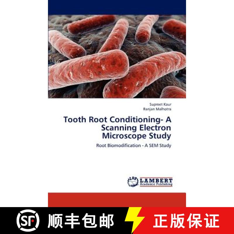 预订 Tooth Root Conditioning- A Scanning Electron Microscope Study [9783846520765]