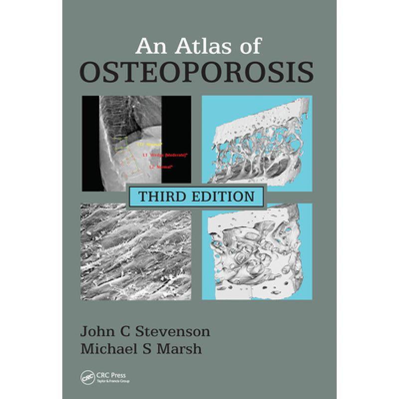 【4周达】An Atlas of Osteoporosis [9780367452810]