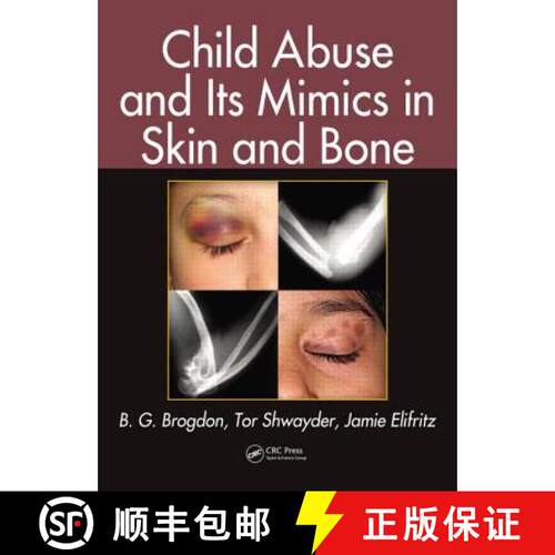 【3-4周达】精装 Child Abuse and Its Mimics in Skin and Bone [9781439855355]