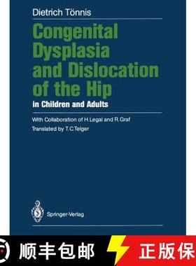 【3-4周达】Congenital Dysplasia and Dislocation of the Hip in Children and Adults [9783642710407]