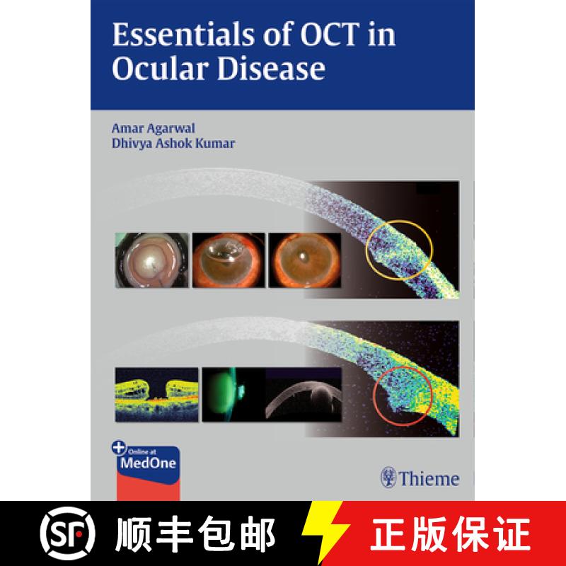 【3-4周达】Essentials of Oct in Ocular Disease [9781626230989]
