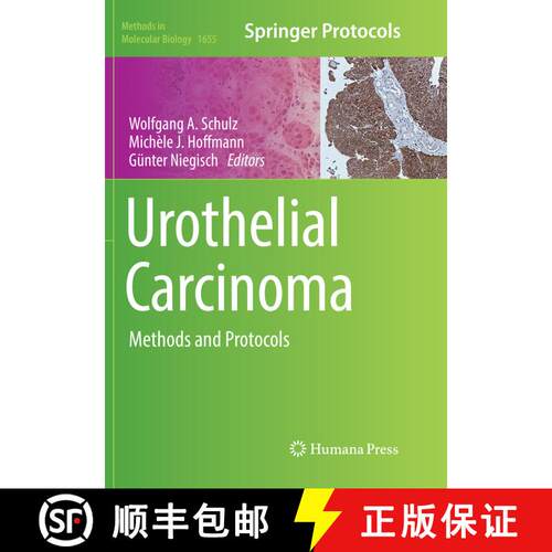 【3-4周达】Urothelial Carcinoma : Methods and Protocols (Softcover reprint of the original 1st ed. 2018) [9781493984251]