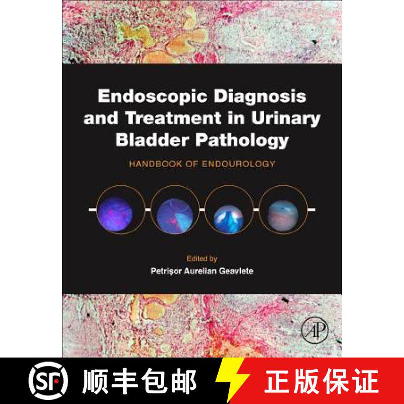 【3-4周达】Endoscopic Diagnosis and Treatment in Urinary Bladder Pathology: Handbook of Endourology [9780128024393]