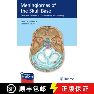 【3-4周达】精装 Meningiomas of the Skull Base – Treatment Nuances in Contemporary Neurosurgery [9783132412866]