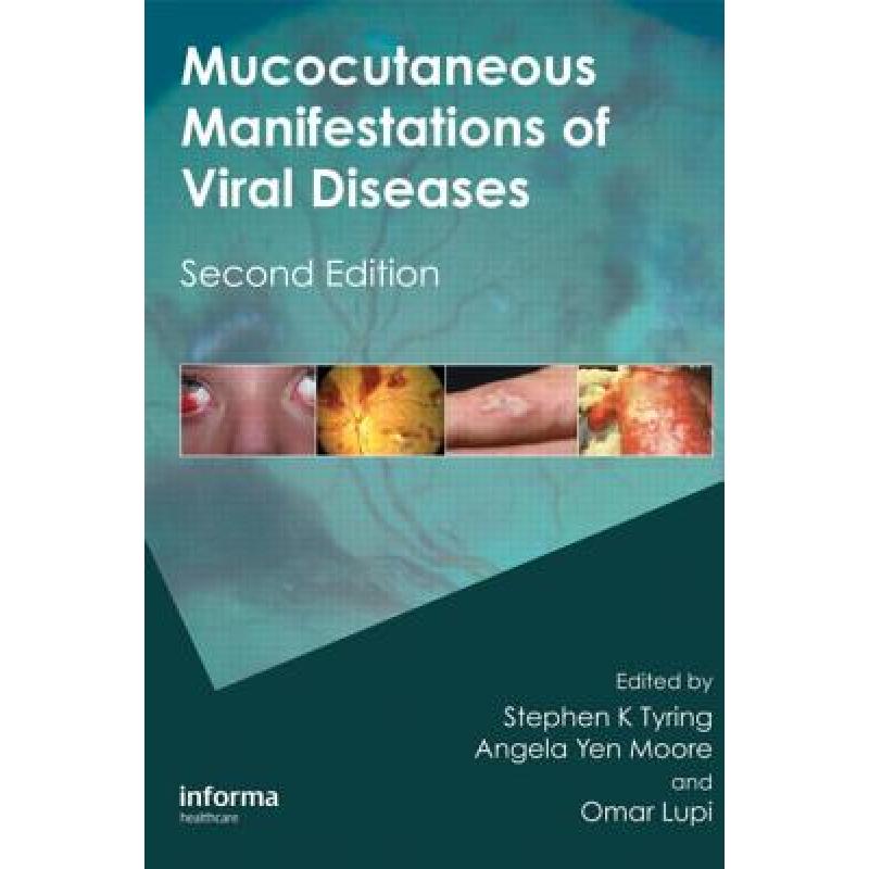 【4周达】Mucocutaneous Manifestations of Viral Diseases: An Illustrated Guide to Diagnosis and Manage... [9781420073126]