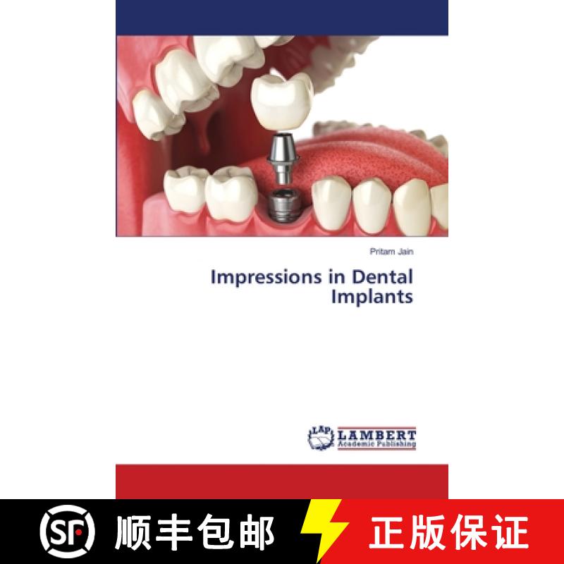 预订 Impressions in Dental Implants [9786139829828]