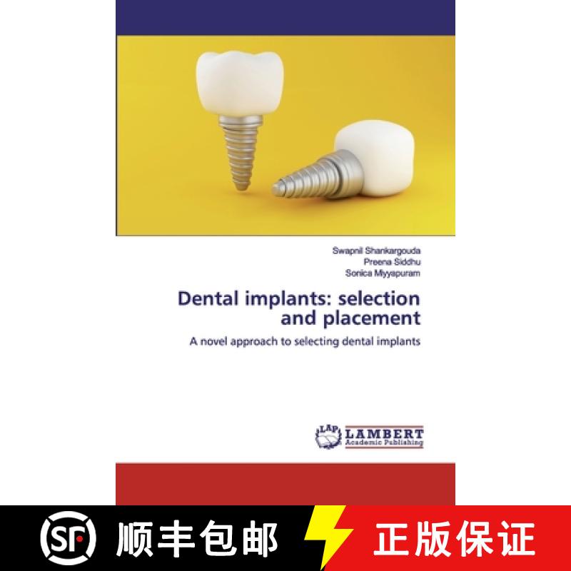 预订 Dental implants: selection and placement [9786200324221]