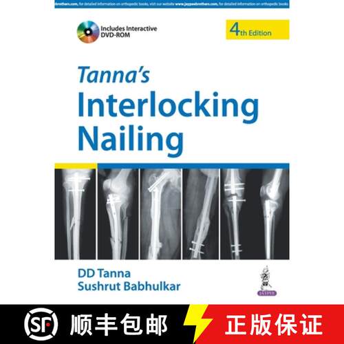 【3-4周达】Tanna'S Interlocking Nailing With Dvd-Rom [9789352500604]