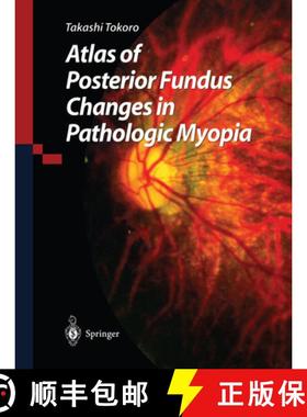 【3-4周达】Atlas of Posterior Fundus Changes in Pathologic Myopia [9784431702252]