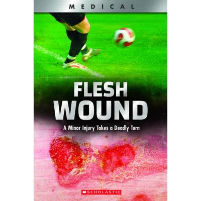 【4周达】Flesh Wound: A Minor Injury Takes a Deadly Turn (XBooks): A Minor Injury Takes a Deadly Turn [9780531132968]