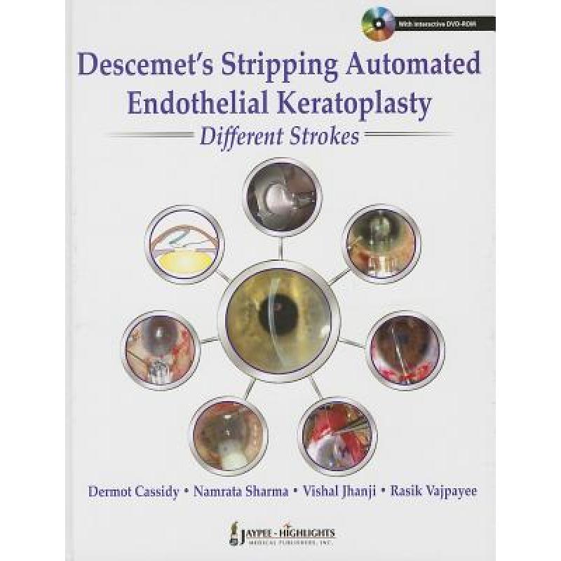 【4周达】Descemet's Stripping Automated Endothelial Keratoplasty: Different Strokes[With DVD ROM][9789350903285]-封面