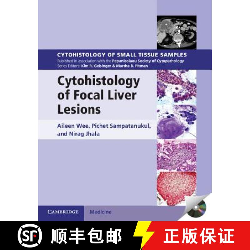 【3-4周达】Cytohistology of Focal Liver Lesions: - Cytohistology of Focal Liver Lesions [9781107024175]
