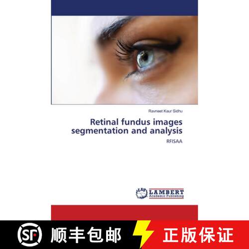 【3-4周达】Retinal fundus images segmentation and analysis [9786206157991]