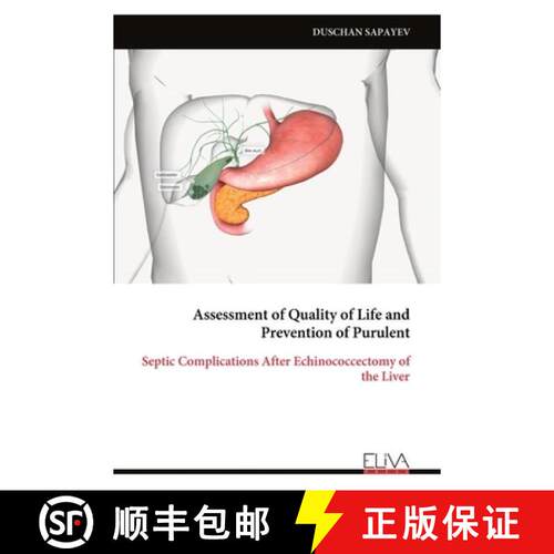 【3-4周达】Assessment of Quality of Life and Prevention of Purulent: Septic Complications After Echin... [9789999344623]