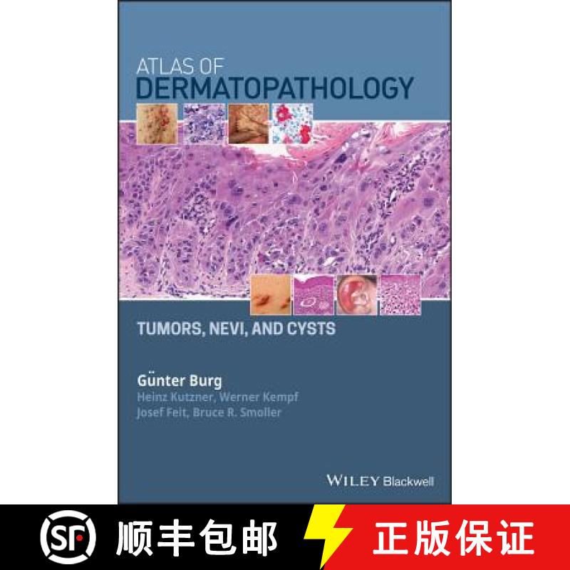 【3-4周达】Atlas of Dermatopathology Tumors, Nevi, and Cysts: Tumors, Nevi, and Cysts [9781119371540]