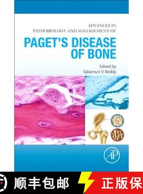 【3-4周达】Advances in Pathobiology and Management of Paget's Disease of Bone [9780128050835]