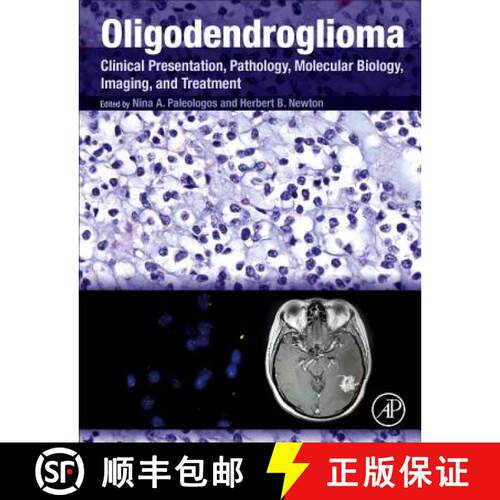 【3-4周达】精装 Oligodendroglioma: Clinical Presentation, Pathology, Molecular Biology, Imaging, and ... [9780128131589]