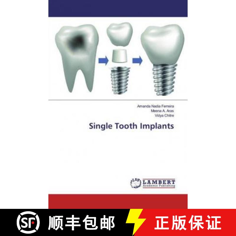 预订 Single Tooth Implants [9786200007216]