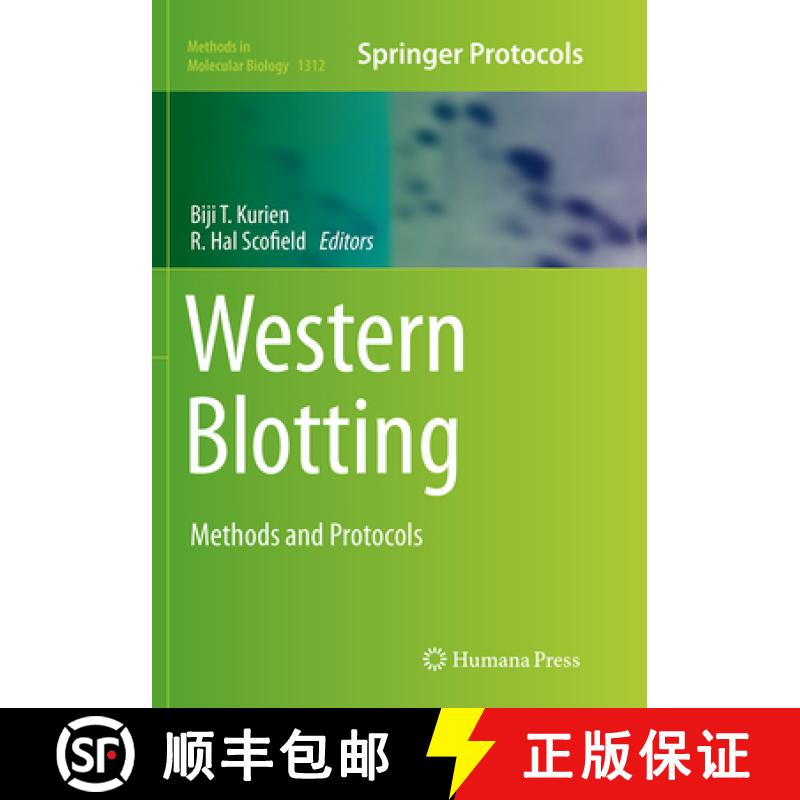 【4周达】Western Blotting: Methods and Protocols [9781493955961]