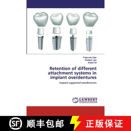 预订 Retention of different attachment systems in implant overdentures [9786200474292]