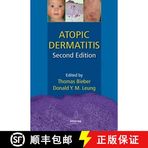 【3-4周达】精装 ATOPIC DERMATITIS 2E [9781420077988]