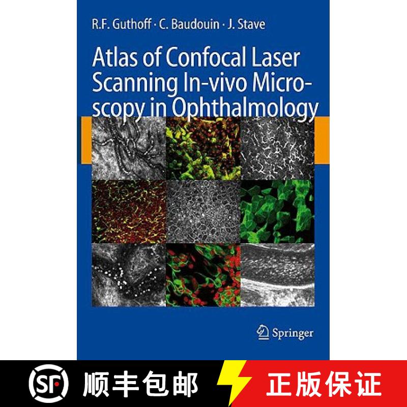 【3-4周达】Atlas of Confocal Laser Scanning In-Vivo Microscopy in Ophthalmology: Principles and Appli... [9783540327059]
