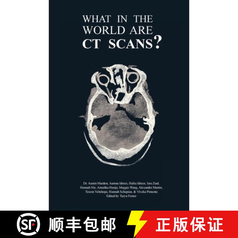 【3-4周达】What in the World are CT Scans? [9781773692265]