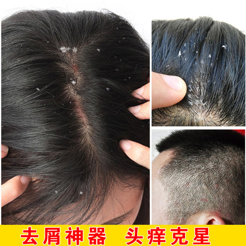 康王去头皮屑价格 康王去头皮屑图片 星期三