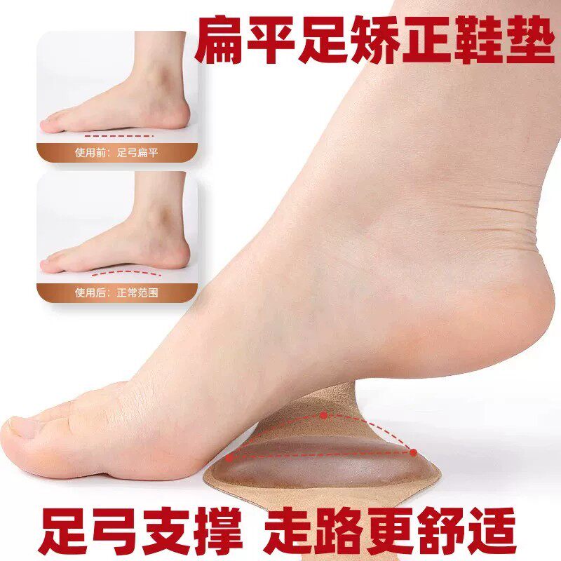 足弓垫扁平足鞋垫足弓支撑平足底矫正器足外翻训练男女防护脚心垫