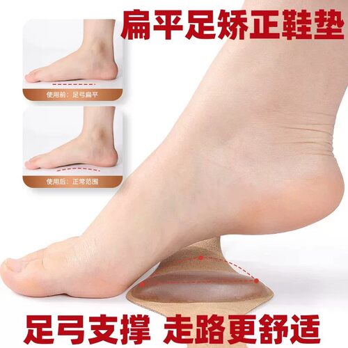 足弓垫扁平足鞋垫足弓脚心垫
