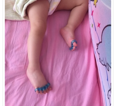幼儿童防磨拇指外翻脚趾矫正器
