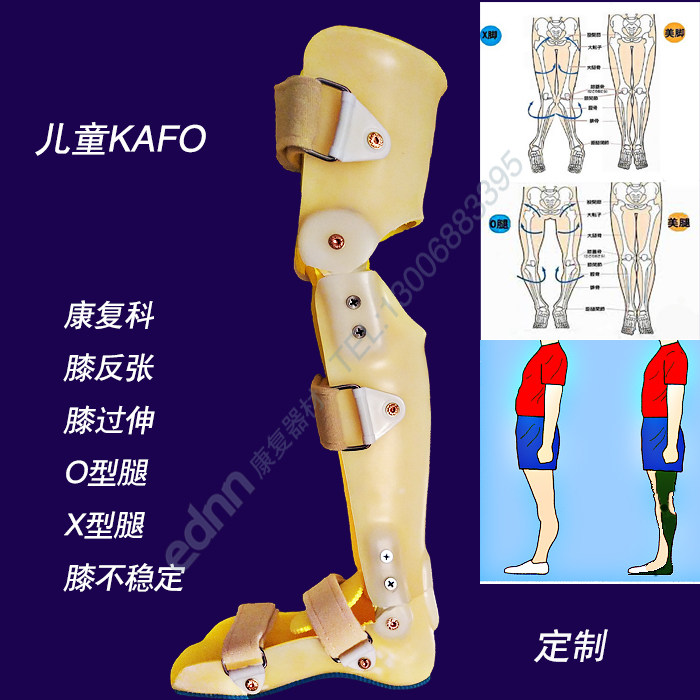 儿童矫正鞋膝踝足/膝屈曲反张/膝过伸支具X型腿O型腿 踮脚 跟腱紧