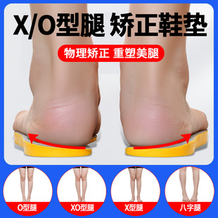 日本XO型腿纠正小腿外翻膝盖内扣内外八字脚矫正鞋垫内旋鼓包神器