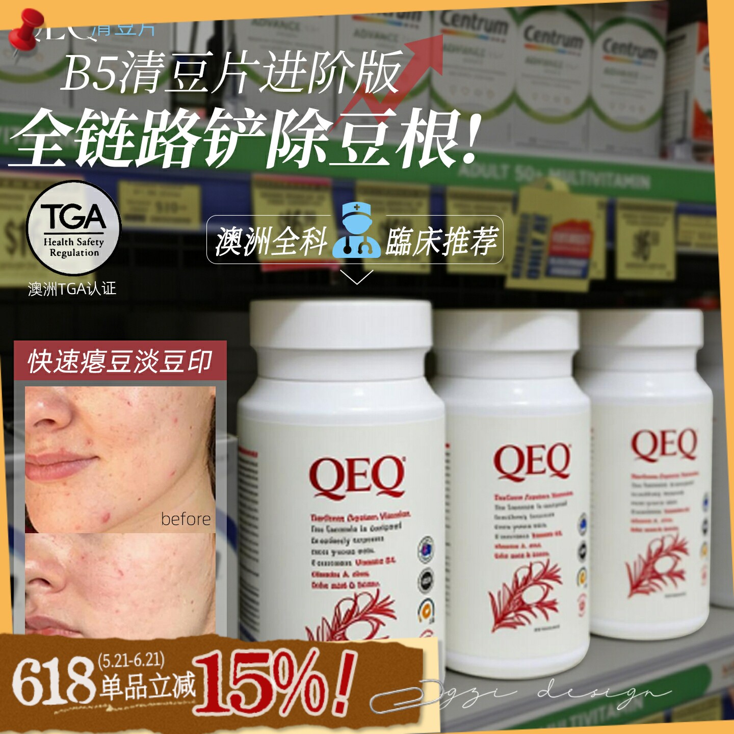 油痘敏烂脸内服!QEQ维生素B5清痘片祛痘片黑头粉刺控油内调