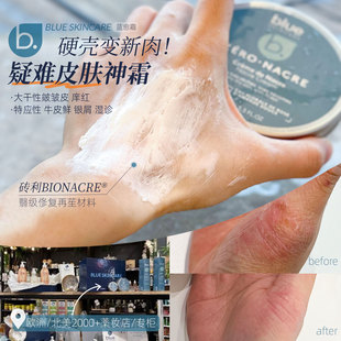 强韧肌肤 Skincare蓝愈霜贝壳霜保湿 专搞问题皮肤 保税法国B.Blue