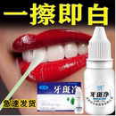 牙斑净去黄牙黑牙结石烟渍茶渍牙垢牙齿美白脱色剂10 白牙神器