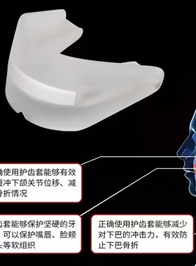李宁运动护齿篮球牙套儿童可咀嚼防磨牙拳击跆拳道专业散打搏击
