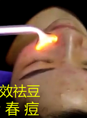 祛痘仪器高周波美容仪臭氧祛痘神器脸部除螨电疗棒杀菌去痘电疗仪