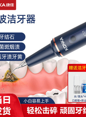 Konka/康佳超声波洁牙器洗牙冲牙去除牙石神器清洁污垢牙石牙垢仪