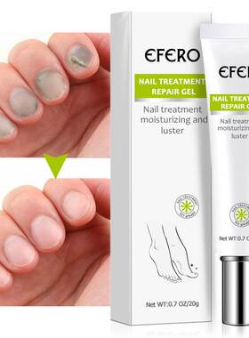 Anti Fungal Nail Repair Gel Treatment Anti Infection Serum O